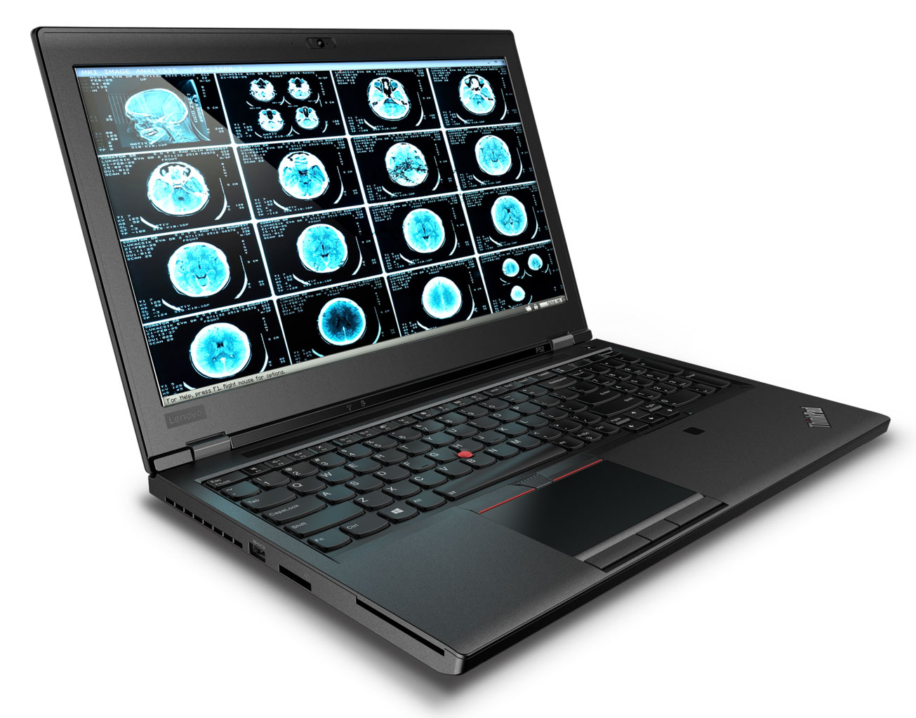 Lenovo ThinkPad P52 - i7-8850H · Quadro P3200 · 15.6”, Full HD